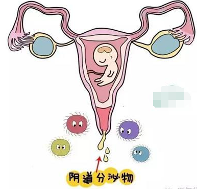 阴道分泌物蜜桃视频在线观看免费的一般性状检查类型