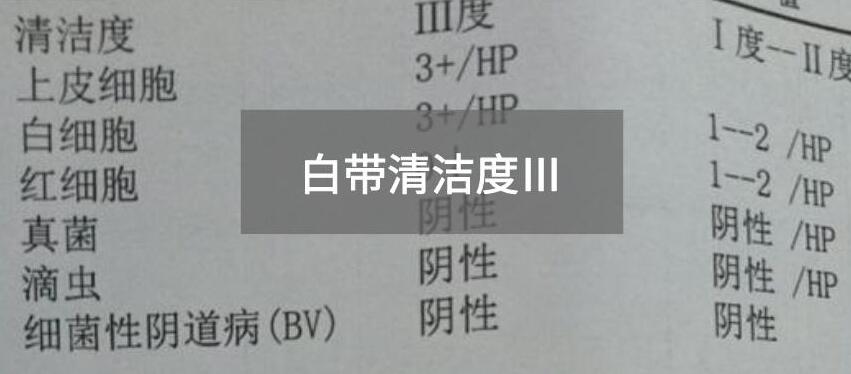 今天快讯！全自动白带蜜桃视频黄网站生产厂家蜜桃视频APP下载为您官方解释白带清洁度3的意思