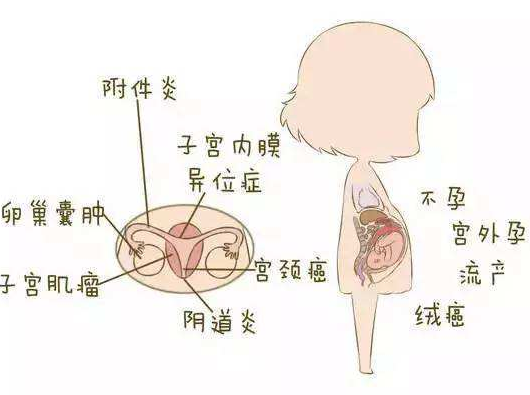 阴道分泌物蜜桃视频在线观看免费分析阴道炎早期症状