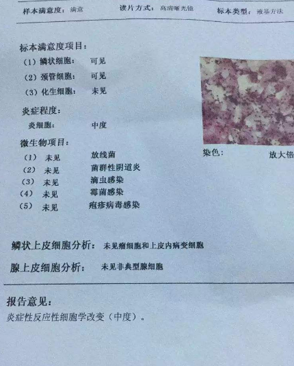 阴道分泌物蜜桃视频在线观看免费厂家教你查看阴道分泌物检测报告
