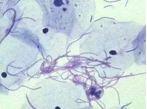 阴道分泌物蜜桃视频在线观看免费厂家探讨白带清洁度3代表什么意思