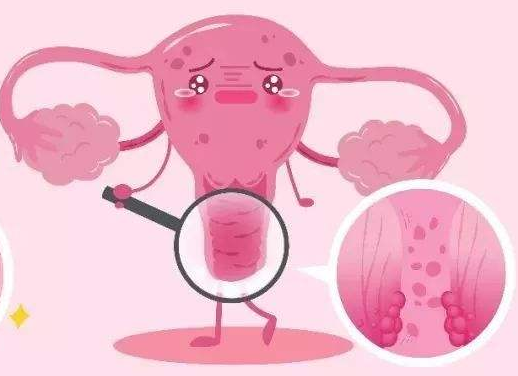 白带常规蜜桃视频黄网站厂家提醒女士做好私密处清洗