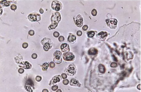 全自动阴道分泌物蜜桃视频在线观看免费剖析阴道分泌物的洁净度规范