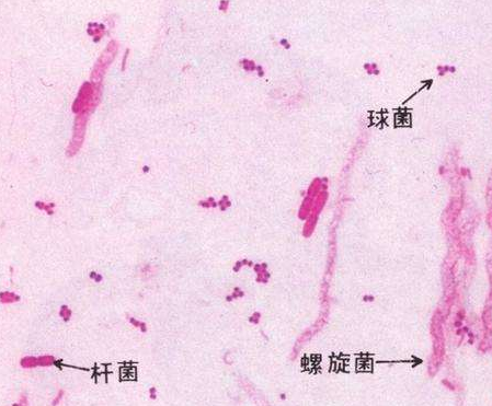 妇科白带蜜桃视频在线观看免费厂家分析白带线索细胞阳性的意义