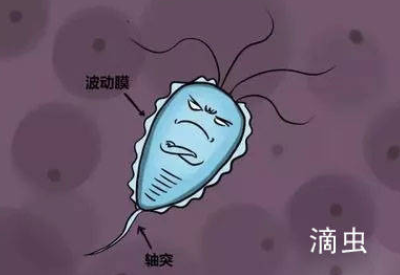 白带蜜桃视频在线观看免费品牌介绍滴虫性阴道炎的早期症状以及预防方法