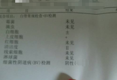 全自动白带蜜桃视频黄网站分享如何看懂白带常规检测报告单