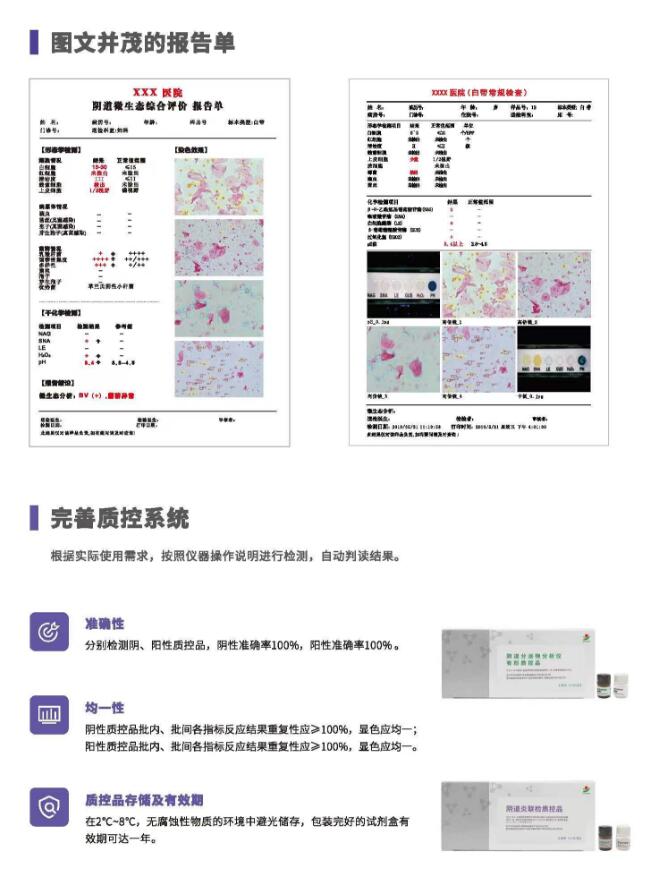 阴道分泌物蜜桃视频黄网站V800报告单